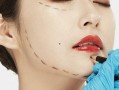 小丽爆料医美视频大全集,医美视频大全集深度解析